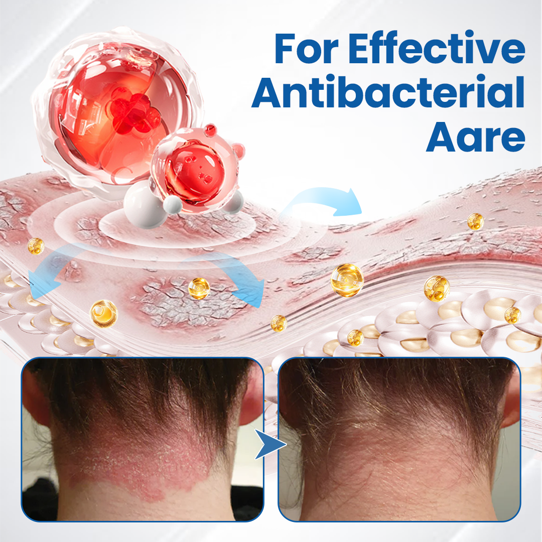 Timilk® Fragile Skin Repair Cream.