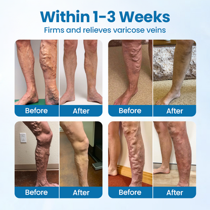 Timilk® VeinGuard Herbal Spray.