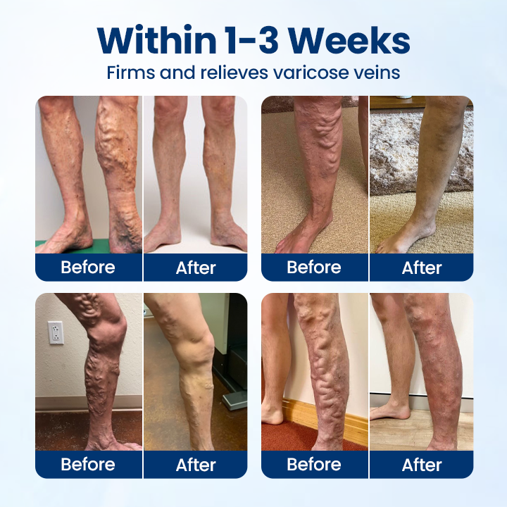 Timilk® VenoRelief Botanical Leg Spray