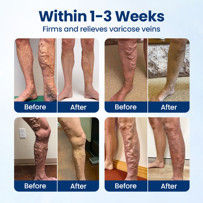 Timilk® VenoRelief Botanical Leg Spray