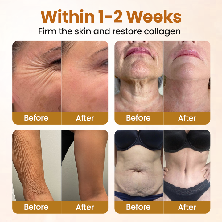 ✨ FIRM • SMOOTH • HYDRATE Biancat® SeraLift Collagen Peptide Firming Mist  💧 For loose, dry & crepey-looking body skin — lightweight, fast-absorbing, non-greasy.