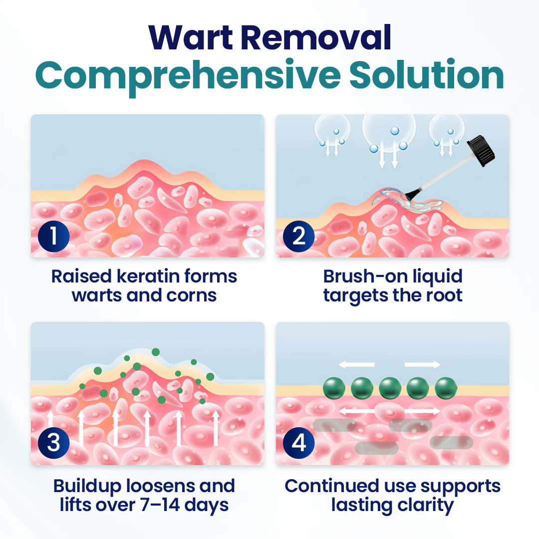 Timilk® WartLift Corn Removal Liquid