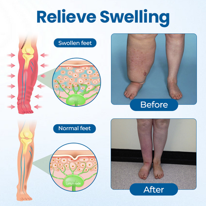 Timilk® Lymphora Swelling Relief Roll-On