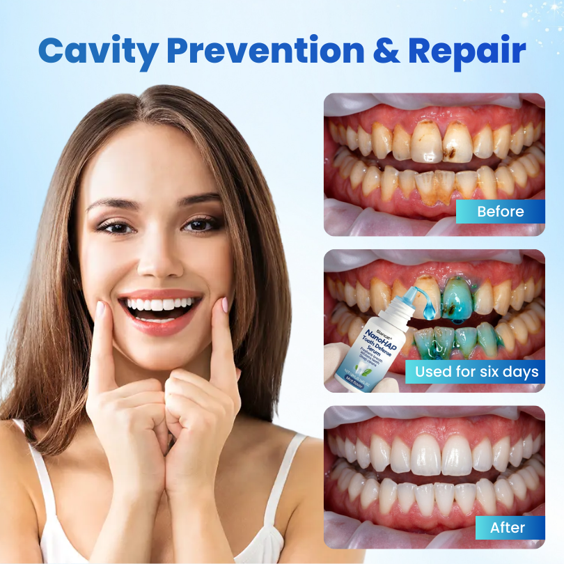 Biancat® SmileCare Tooth Polish.