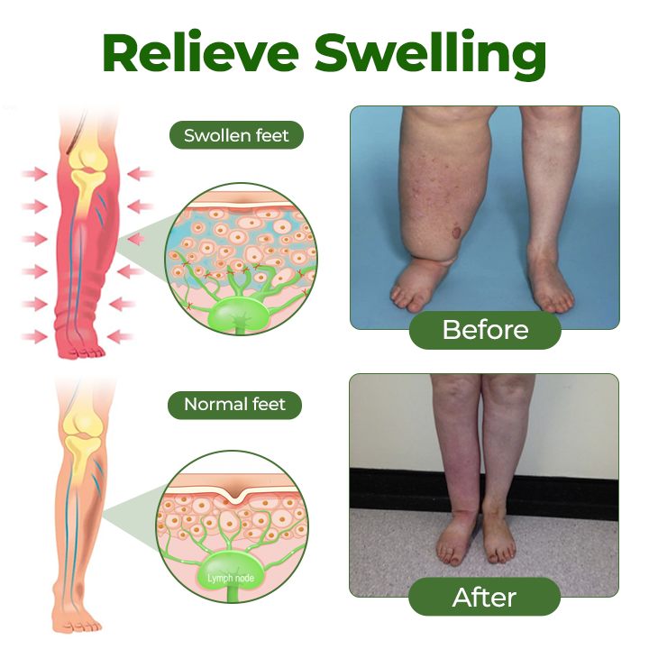 Timilk® LegCare Comfort Cream