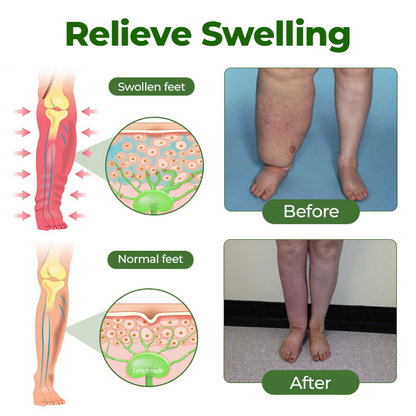 Timilk® LegCare Comfort Cream