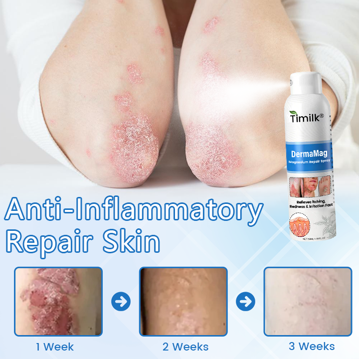 Timilk® DermaMag Magnesium Repair Spray.