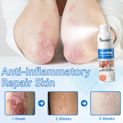 Timilk® DermaMag Magnesium Repair Spray.