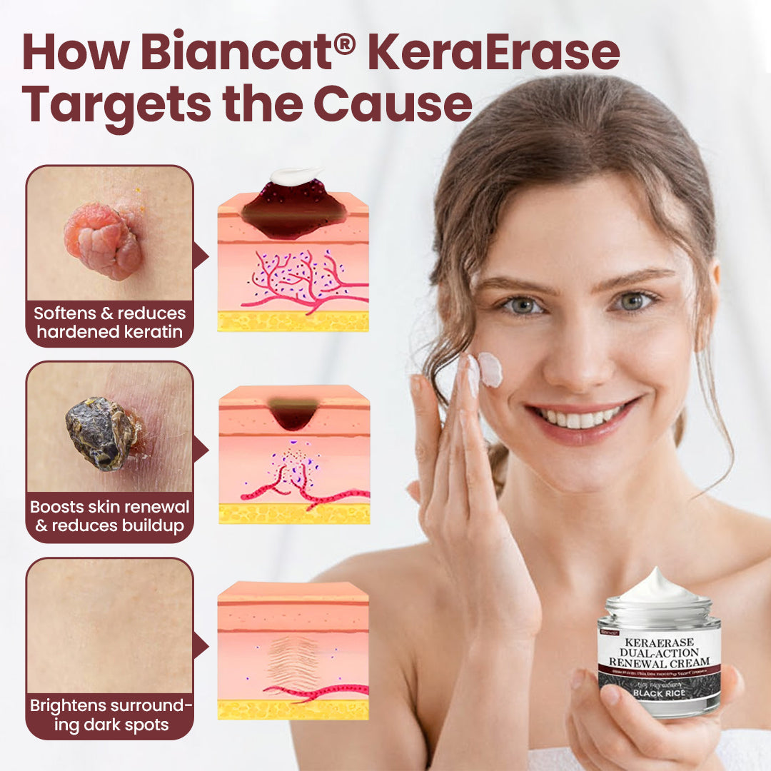Biancat® KeraSoft Renewal Cream