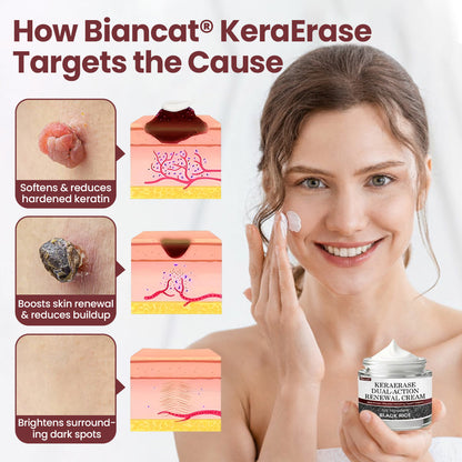 Biancat® KeraSoft Renewal Cream
