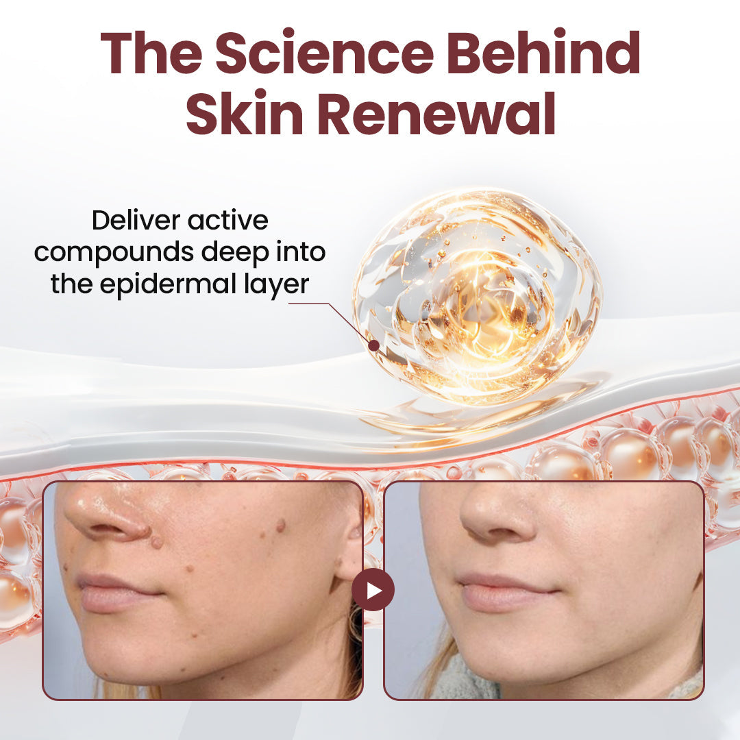 Biancat® KeraSoft Renewal Cream