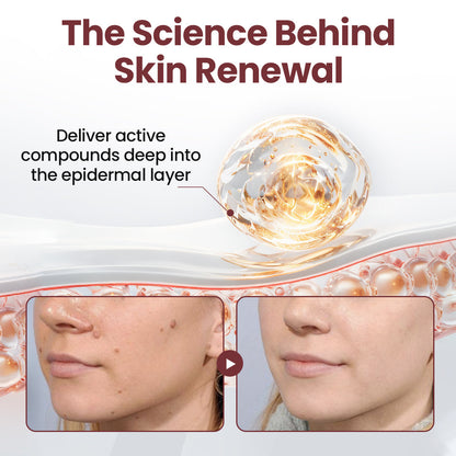 Biancat® KeraSoft Renewal Cream