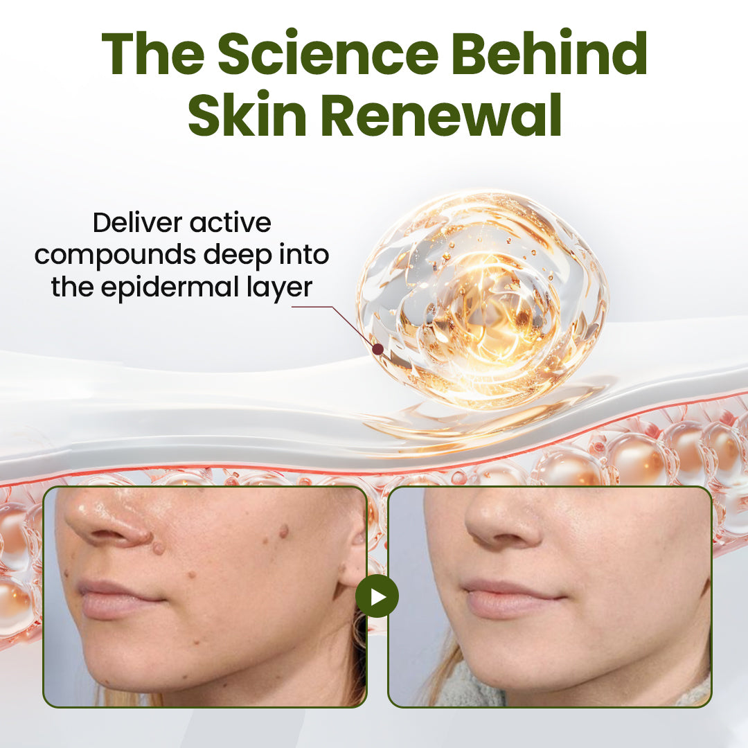 Biancat® MagneCare Renewal Cream
