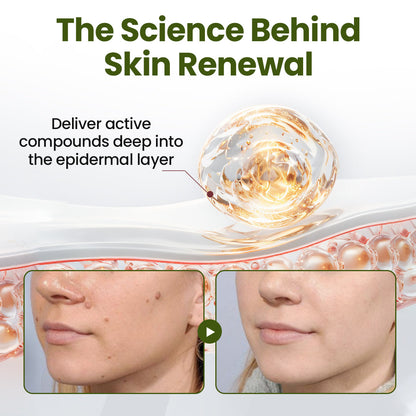 Biancat® MagneCare Renewal Cream