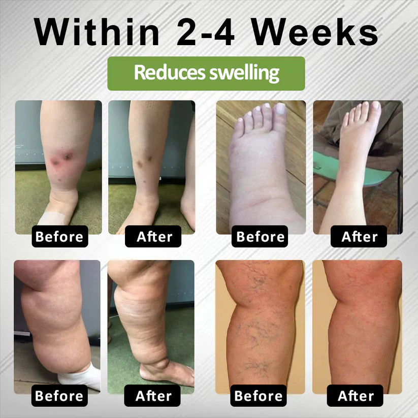 Timilk® LegCare Comfort Cream