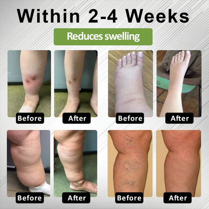 Timilk® LegCare Comfort Cream