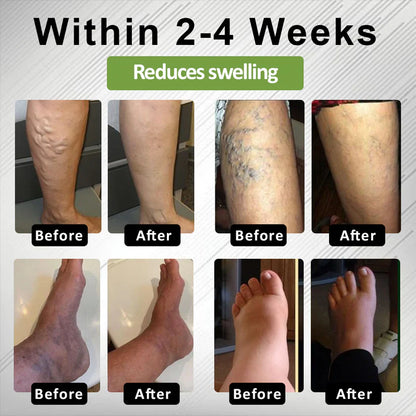 Timilk® LegCare Comfort Cream