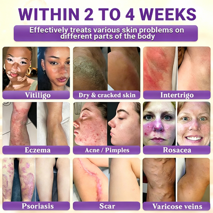 Timilk® Biotin 10-in-1 Skin Restoration Cream