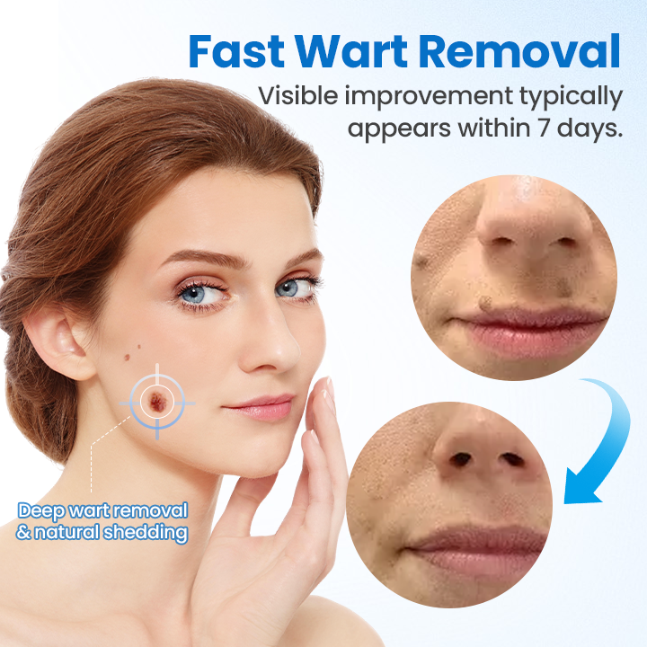 Timilk® TagGone Wart Removal Cream.