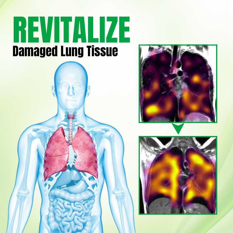 Biancat® RespiPure Herbal Lung Detox Spray.