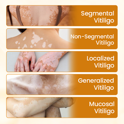 Timilk® VitiCalm Bee Venom Cream