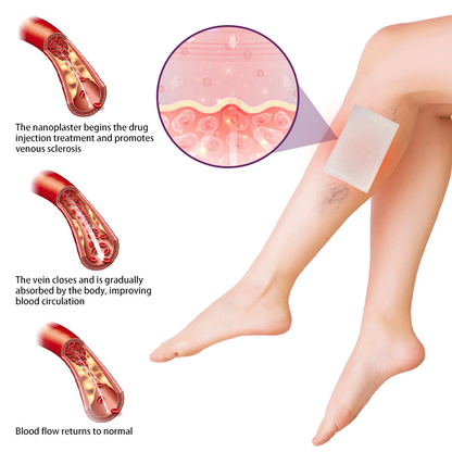 Timilk® Polidocanol Nano Varicose Vein Patch.