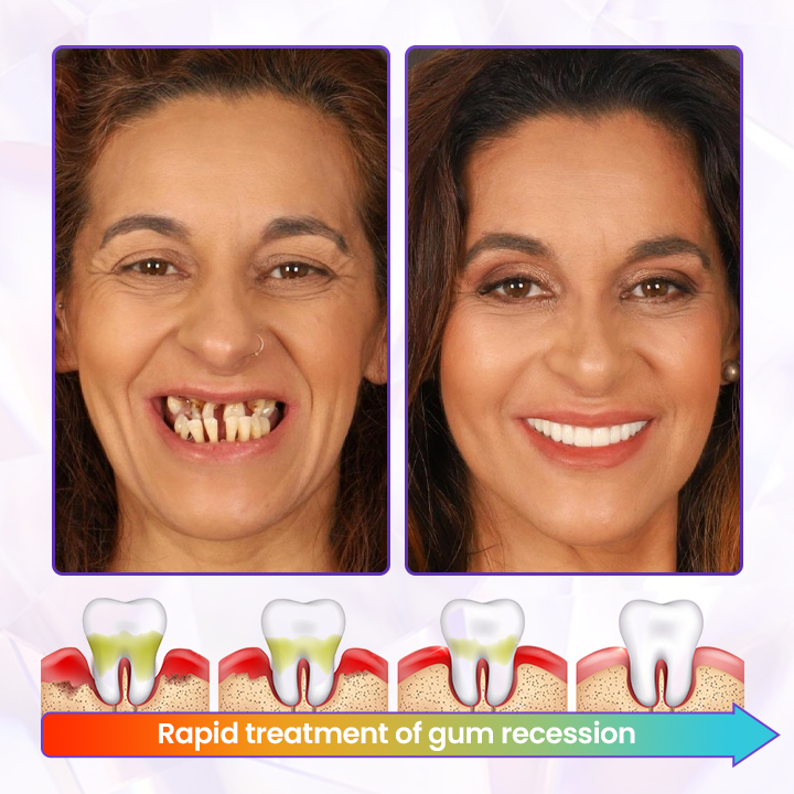 Biancat® BeeRenew Advanced Gum Healing Toothpaste