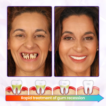 Biancat® BeeRenew Advanced Gum Healing Toothpaste