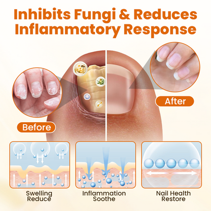 Timilk® FungiBee Advanced Nail Repair Spray.