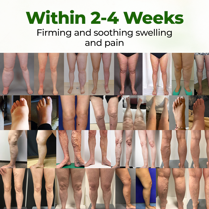 Timilk® LegCare Comfort Cream