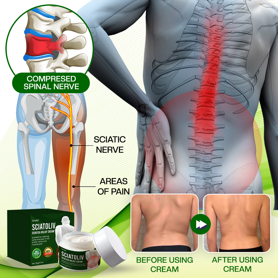 Timilk® Sciatoliv Sciatica Relief Cream