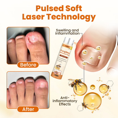Timilk® FungiBee Advanced Nail Repair Spray.