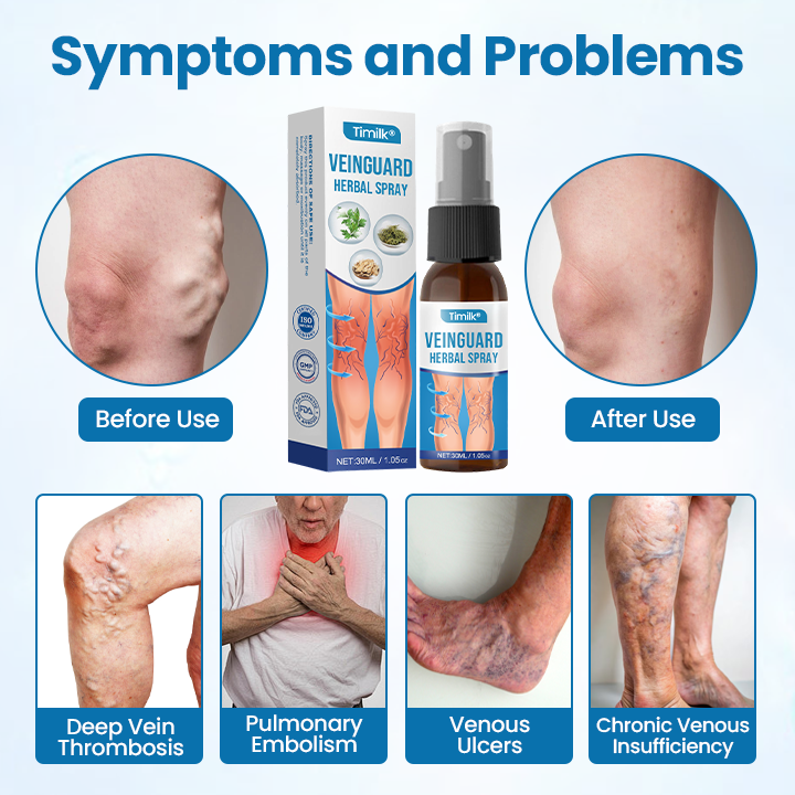 Timilk® VeinGuard Herbal Spray