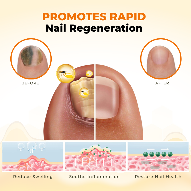 Timilk® NailRevive Bee Venom Anti-fungi Solution