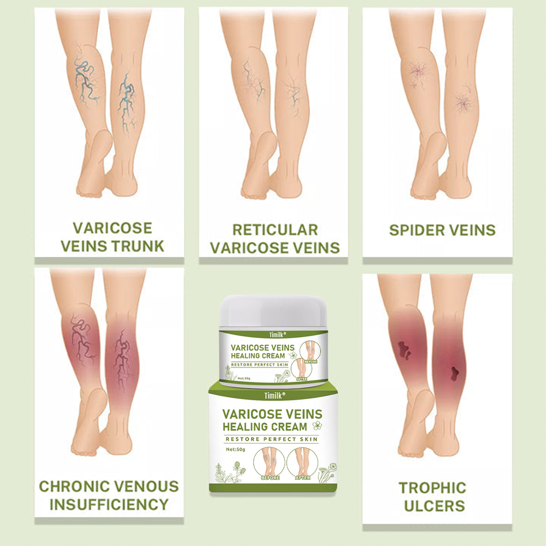 Timilk® Varicose Veins Healing Cream.